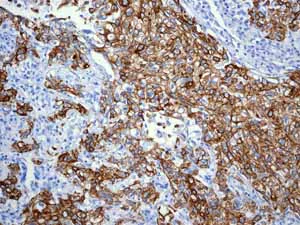 Immunohistochemistry (Formalin/PFA-fixed paraffin-embedded sections) - Anti-Cytokeratin 18 antibody [EPR1626] (AB133263)