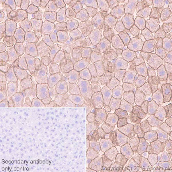 Immunohistochemistry (Formalin/PFA-fixed paraffin-embedded sections) - Anti-Cytokeratin 18 antibody [EPR1626] (AB133263)
