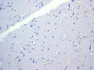 Immunohistochemistry (Formalin/PFA-fixed paraffin-embedded sections) - Anti-Cytokeratin 18 antibody [EPR1626] (ab133263), expandable thumbnail