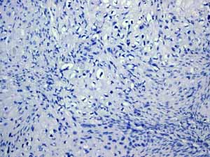 Immunohistochemistry (Formalin/PFA-fixed paraffin-embedded sections) - Anti-Cytokeratin 18 antibody [EPR1626] (ab133263), expandable thumbnail