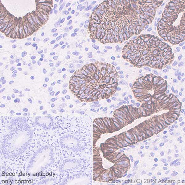 Immunohistochemistry (Formalin/PFA-fixed paraffin-embedded sections) - Anti-Cytokeratin 18 antibody [EPR1626] (AB133263), expandable thumbnail