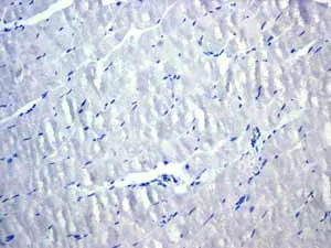 Immunohistochemistry (Formalin/PFA-fixed paraffin-embedded sections) - Anti-Cytokeratin 18 antibody [EPR1626] - BSA and Azide free (AB240054)