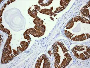 Immunohistochemistry (Formalin/PFA-fixed paraffin-embedded sections) - Anti-Cytokeratin 18 antibody [EPR1626] - BSA and Azide free (AB240054)