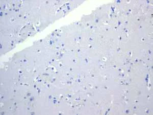 Immunohistochemistry (Formalin/PFA-fixed paraffin-embedded sections) - Anti-Cytokeratin 18 antibody [EPR1626] - BSA and Azide free (AB240054)