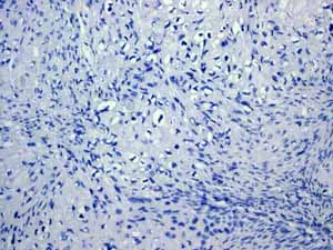 Immunohistochemistry (Formalin/PFA-fixed paraffin-embedded sections) - Anti-Cytokeratin 18 antibody [EPR1626] - BSA and Azide free (AB240054)
