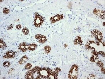 Immunohistochemistry (Formalin/PFA-fixed paraffin-embedded sections) - Anti-Cytokeratin 18 antibody [EPR1626] - BSA and Azide free (AB240054)