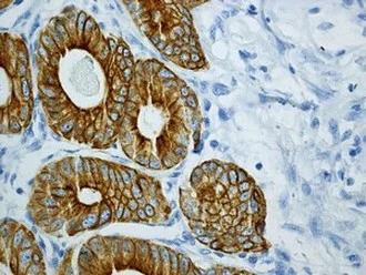 Immunohistochemistry (Formalin/PFA-fixed paraffin-embedded sections) - Anti-Cytokeratin 18 antibody [EPR1626] - BSA and Azide free (AB240054)