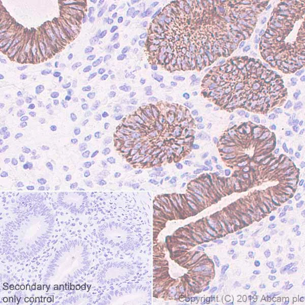 Immunohistochemistry (Formalin/PFA-fixed paraffin-embedded sections) - Anti-Cytokeratin 18 antibody [EPR1626] - BSA and Azide free (AB240054)