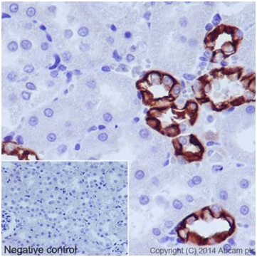 Immunohistochemistry (Formalin/PFA-fixed paraffin-embedded sections) - Anti-Cytokeratin 18 antibody [EPR17347] (AB181597), expandable thumbnail