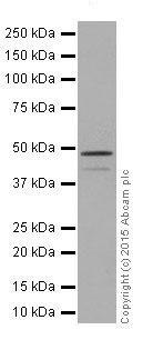 Western blot - Anti-Cytokeratin 18 antibody [EPR17347] (ab181597), expandable thumbnail