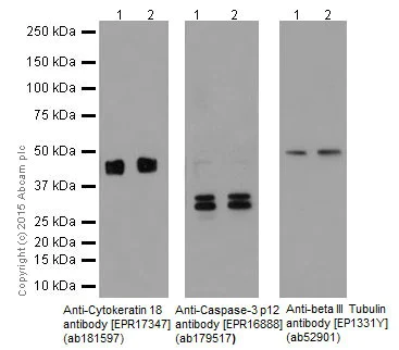 Western blot - Anti-Cytokeratin 18 antibody [EPR17347] (AB181597)