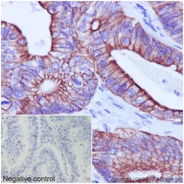 Immunohistochemistry (Formalin/PFA-fixed paraffin-embedded sections) - Anti-Cytokeratin 18 antibody [EPR17347] - BSA and Azide free (AB240254)
