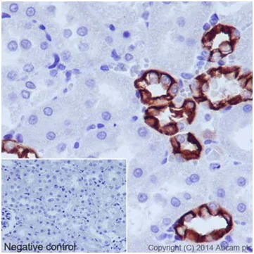 Immunohistochemistry (Formalin/PFA-fixed paraffin-embedded sections) - Anti-Cytokeratin 18 antibody [EPR17347] - BSA and Azide free (AB240254)