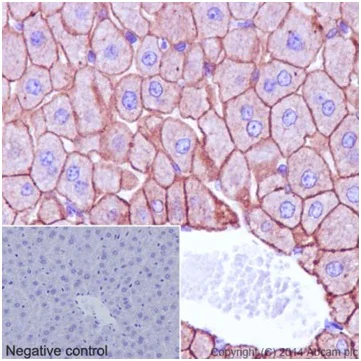 Immunohistochemistry (Formalin/PFA-fixed paraffin-embedded sections) - Anti-Cytokeratin 18 antibody [EPR17347] - BSA and Azide free (AB240254)