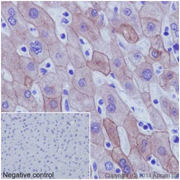 Immunohistochemistry (Formalin/PFA-fixed paraffin-embedded sections) - Anti-Cytokeratin 18 antibody [EPR17347] - BSA and Azide free (AB240254)