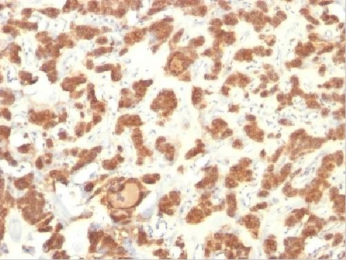 Immunohistochemistry (Formalin/PFA-fixed paraffin-embedded sections) - Anti-Cytokeratin 18 antibody [KRT18/834, KRT18/835, KRT18/836, KRT18/1190] (AB215904), expandable thumbnail