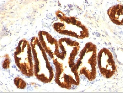 Immunohistochemistry (Formalin/PFA-fixed paraffin-embedded sections) - Anti-Cytokeratin 18 antibody [KRT18/834, KRT18/835, KRT18/836, KRT18/1190] (AB215904), expandable thumbnail
