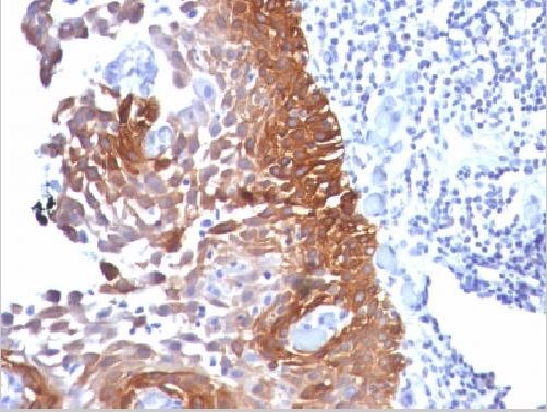 Immunohistochemistry (Formalin/PFA-fixed paraffin-embedded sections) - Anti-Cytokeratin 18 antibody [KRT18/834, KRT18/835, KRT18/836, KRT18/1190] (AB215904), expandable thumbnail