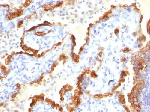 Immunohistochemistry (Formalin/PFA-fixed paraffin-embedded sections) - Anti-Cytokeratin 18 antibody [KRT18/834, KRT18/835, KRT18/836, KRT18/1190] (ab215904), expandable thumbnail