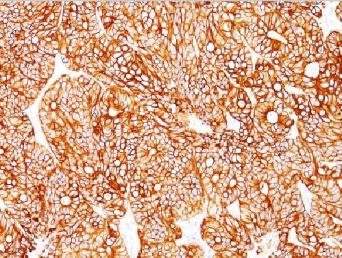 Immunohistochemistry (Formalin/PFA-fixed paraffin-embedded sections) - Anti-Cytokeratin 18 antibody [KRT18/834, KRT18/835, KRT18/836, KRT18/1190] (AB215904), expandable thumbnail