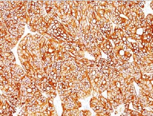Immunohistochemistry (Formalin/PFA-fixed paraffin-embedded sections) - Anti-Cytokeratin 18 antibody [KRT18/834, KRT18/835, KRT18/836, KRT18/1190] (AB215904)