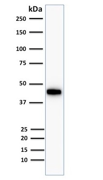Western blot - Anti-Cytokeratin 18 antibody [KRT18/834, KRT18/835, KRT18/836, KRT18/1190] (AB215904), expandable thumbnail