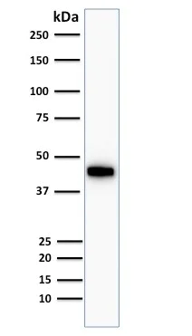 Western blot - Anti-Cytokeratin 18 antibody [KRT18/834, KRT18/835, KRT18/836, KRT18/1190] (AB215904)