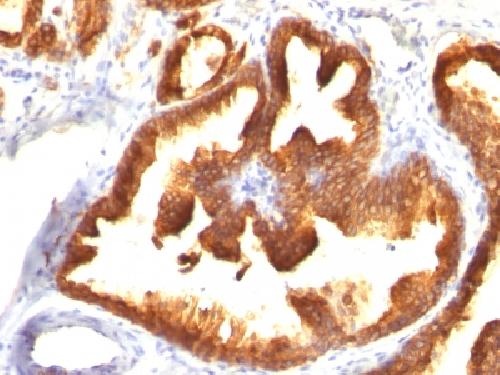 Immunohistochemistry (Formalin/PFA-fixed paraffin-embedded sections) - Anti-Cytokeratin 18 antibody [KRT18/836] - BSA and Azide free (AB216027), expandable thumbnail