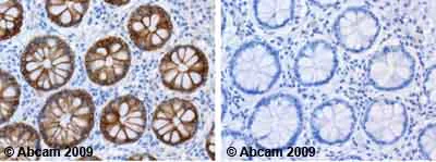 Immunohistochemistry (Formalin/PFA-fixed paraffin-embedded sections) - Anti-Cytokeratin 18 antibody [LDK18] (AB31844)