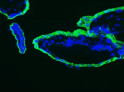 Immunohistochemistry (Frozen sections) - Anti-Cytokeratin 18 antibody [RGE53] (AB9217)