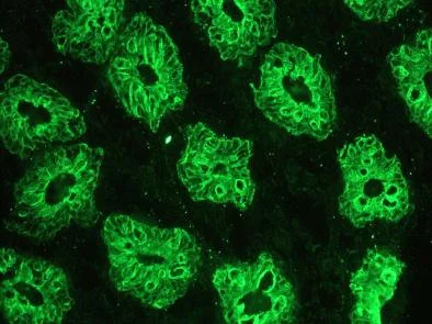 Immunohistochemistry (Frozen sections) - Anti-Cytokeratin 18 antibody [RGE53] (AB9217)