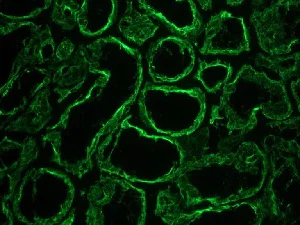 Immunohistochemistry (Frozen sections) - Anti-Cytokeratin 18 antibody [RGE53] (AB9217)