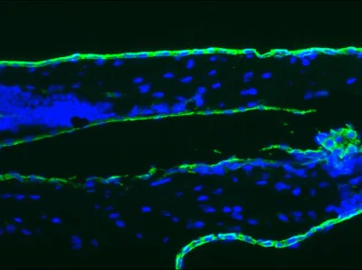 Immunohistochemistry (Frozen sections) - Anti-Cytokeratin 18 antibody [RGE53] (AB9217)