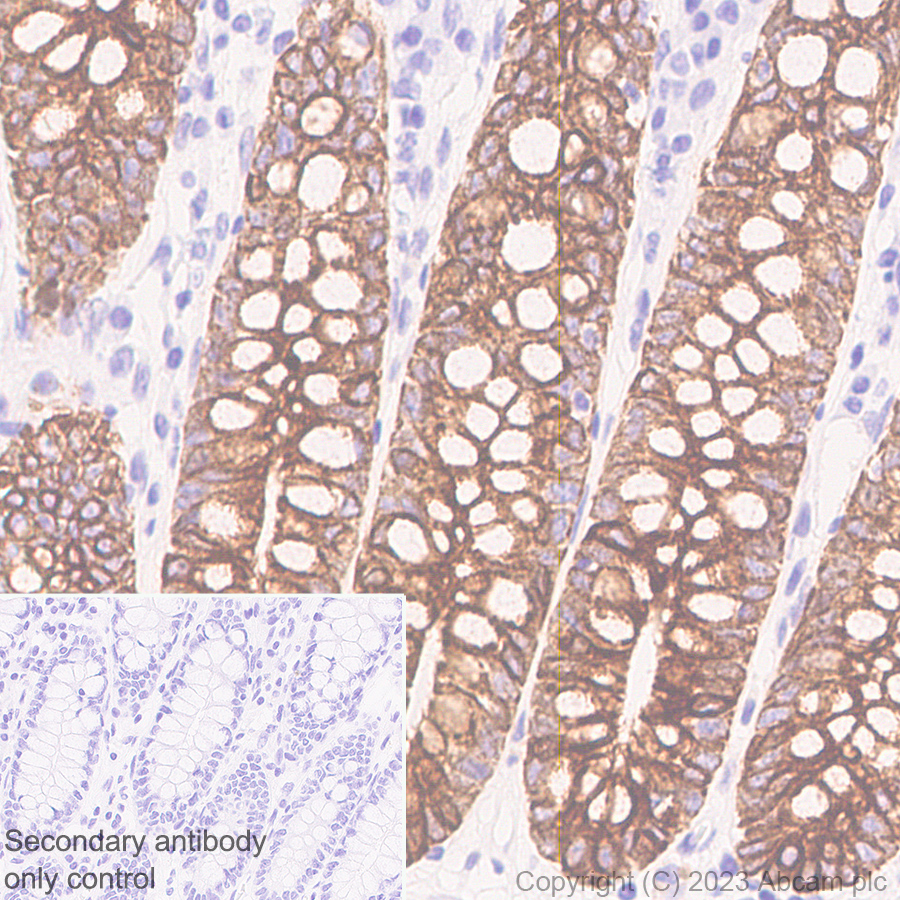 Immunohistochemistry (Formalin/PFA-fixed paraffin-embedded sections) - Anti-Cytokeratin 18 antibody [RM1051] - BSA and Azide free (ab315097), expandable thumbnail