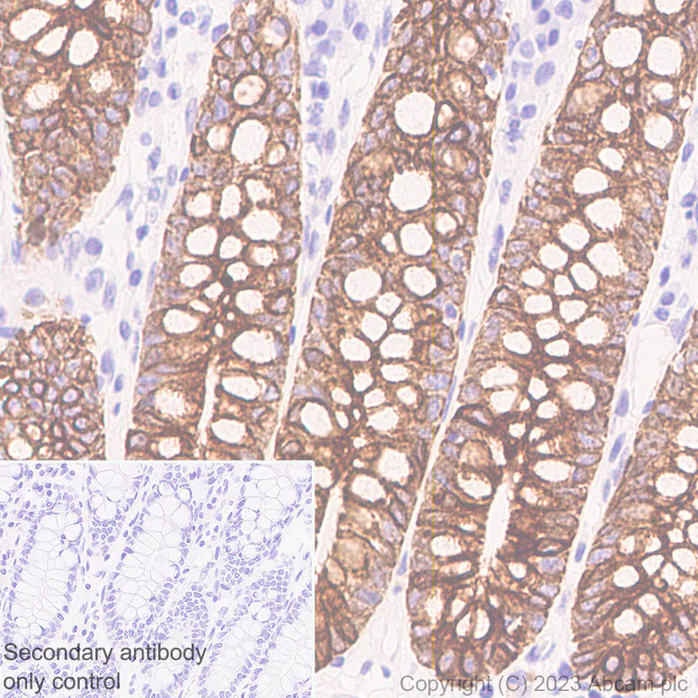 Immunohistochemistry (Formalin/PFA-fixed paraffin-embedded sections) - Anti-Cytokeratin 18 antibody [RM1051] - BSA and Azide free (AB315097)