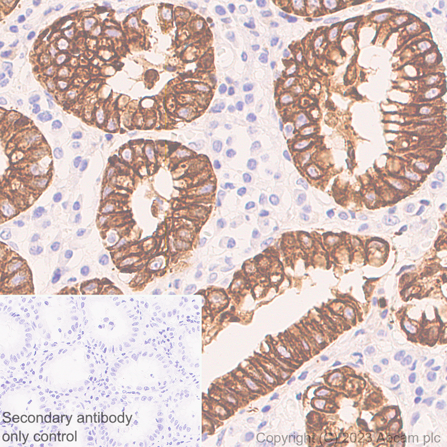 Immunohistochemistry (Formalin/PFA-fixed paraffin-embedded sections) - Anti-Cytokeratin 18 antibody [RM1051] - BSA and Azide free (ab315097), expandable thumbnail