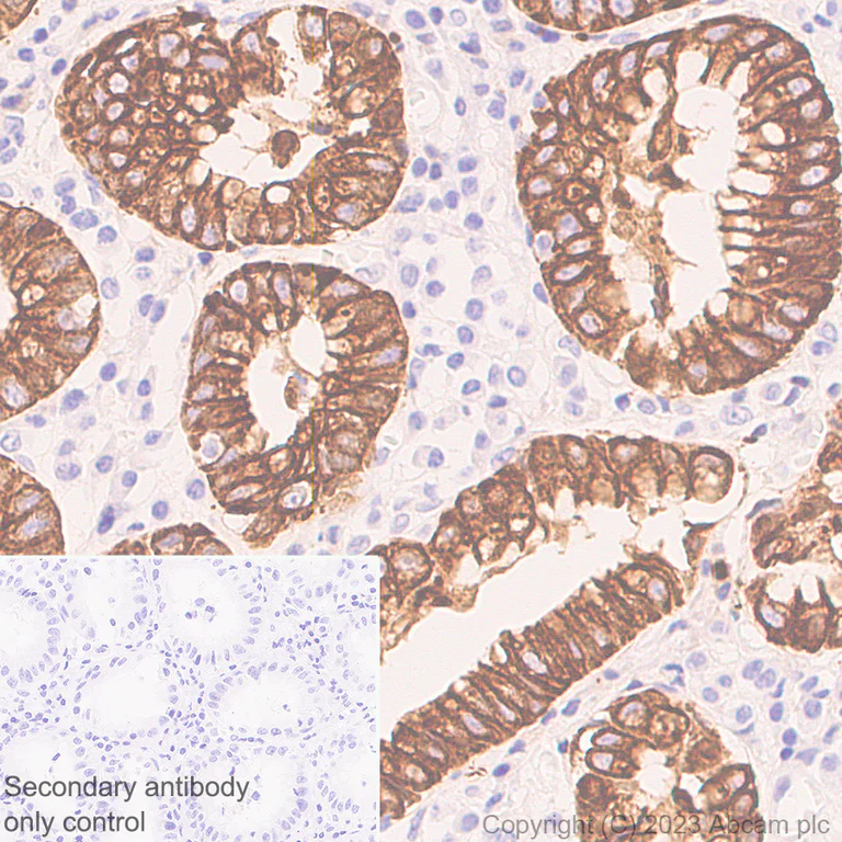 Immunohistochemistry (Formalin/PFA-fixed paraffin-embedded sections) - Anti-Cytokeratin 18 antibody [RM1051] - BSA and Azide free (AB315097)
