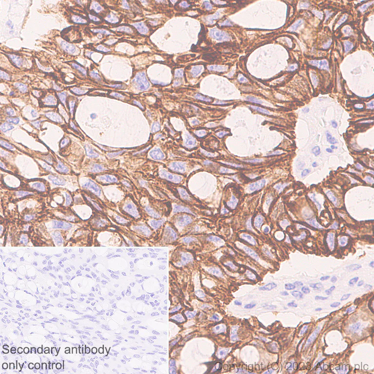 Immunohistochemistry (Formalin/PFA-fixed paraffin-embedded sections) - Anti-Cytokeratin 18 antibody [RM1051] - BSA and Azide free (AB315097)