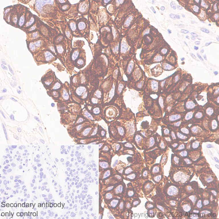 Immunohistochemistry (Formalin/PFA-fixed paraffin-embedded sections) - Anti-Cytokeratin 18 antibody [RM1051] - BSA and Azide free (AB315097)