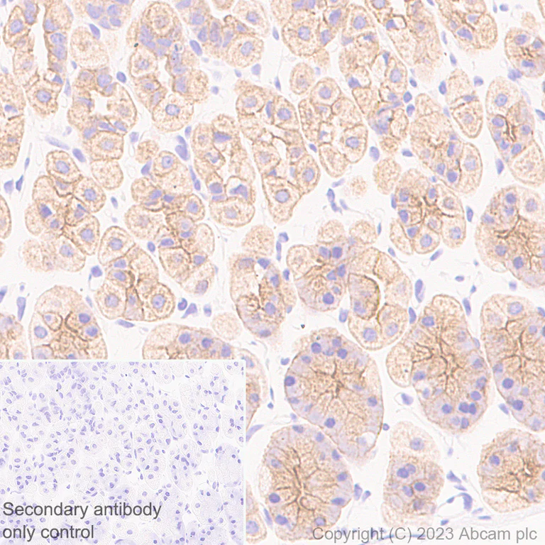 Immunohistochemistry (Formalin/PFA-fixed paraffin-embedded sections) - Anti-Cytokeratin 18 antibody [RM1051] - BSA and Azide free (AB315097)