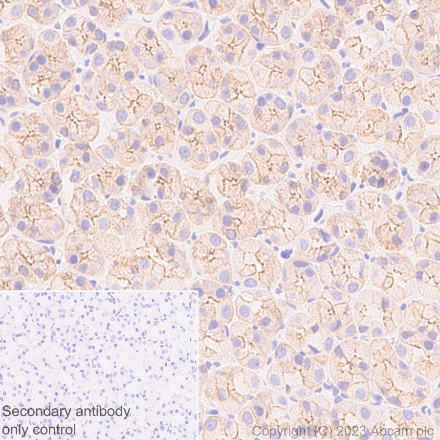 Immunohistochemistry (Formalin/PFA-fixed paraffin-embedded sections) - Anti-Cytokeratin 18 antibody [RM1051] - BSA and Azide free (ab315097), expandable thumbnail