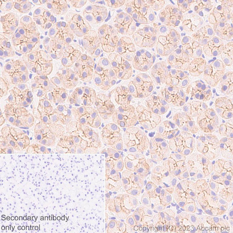 Immunohistochemistry (Formalin/PFA-fixed paraffin-embedded sections) - Anti-Cytokeratin 18 antibody [RM1051] - BSA and Azide free (AB315097)