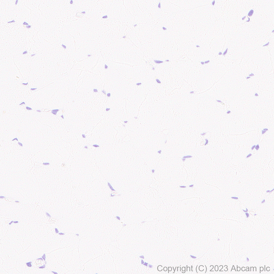 Immunohistochemistry (Formalin/PFA-fixed paraffin-embedded sections) - Anti-Cytokeratin 18 antibody [RM1051] - BSA and Azide free (ab315097), expandable thumbnail