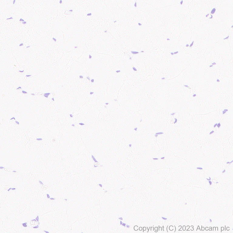 Immunohistochemistry (Formalin/PFA-fixed paraffin-embedded sections) - Anti-Cytokeratin 18 antibody [RM1051] - BSA and Azide free (AB315097)