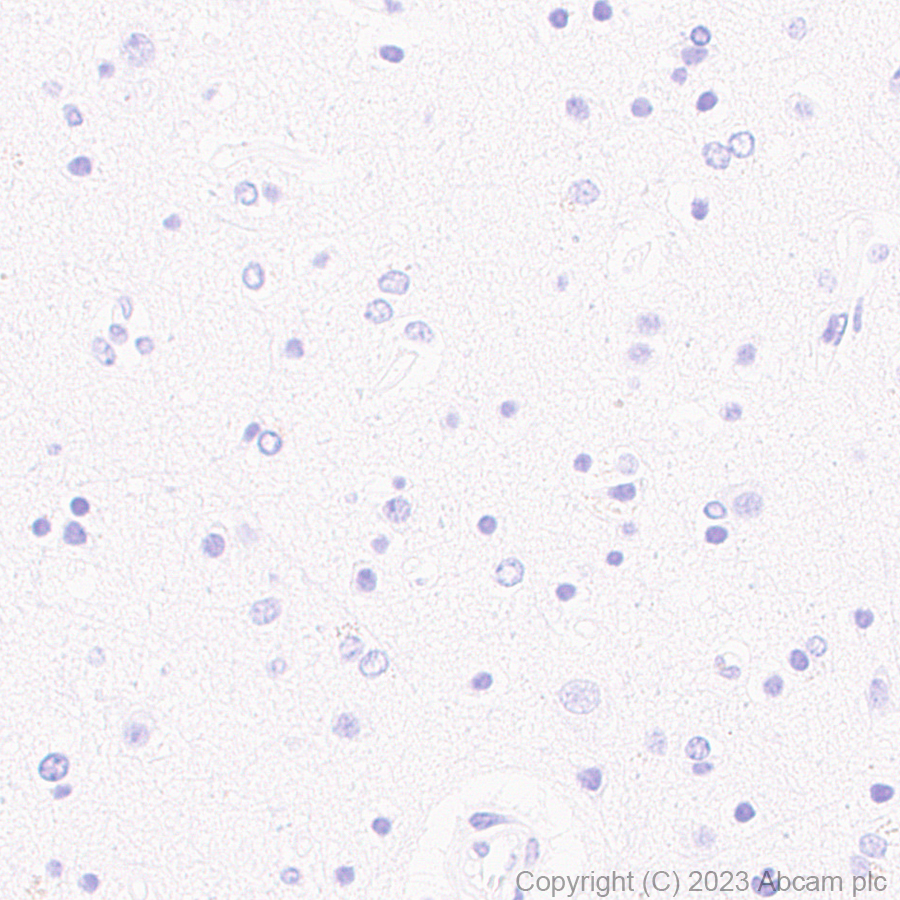 Immunohistochemistry (Formalin/PFA-fixed paraffin-embedded sections) - Anti-Cytokeratin 18 antibody [RM1051] - BSA and Azide free (ab315097), expandable thumbnail