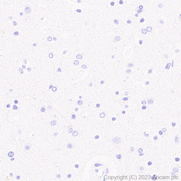 Immunohistochemistry (Formalin/PFA-fixed paraffin-embedded sections) - Anti-Cytokeratin 18 antibody [RM1051] - BSA and Azide free (AB315097)