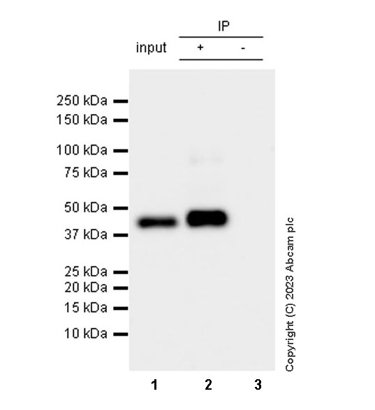 Immunoprecipitation - Anti-Cytokeratin 18 antibody [RM1051] - BSA and Azide free (AB315097), expandable thumbnail