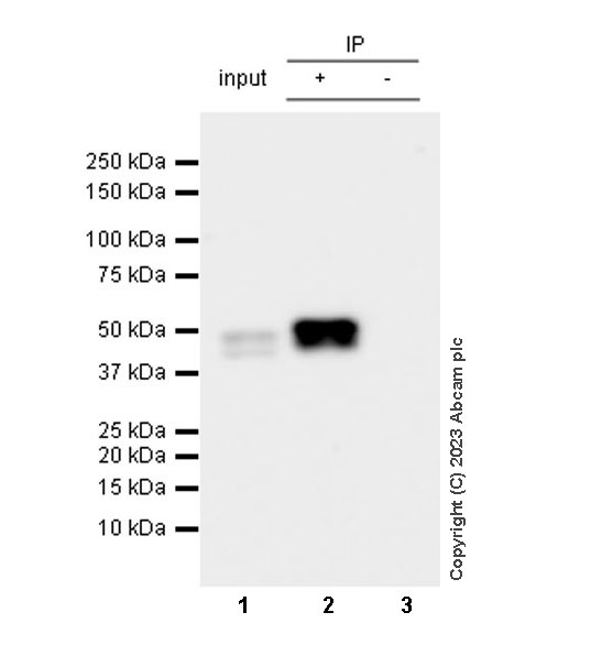 Immunoprecipitation - Anti-Cytokeratin 18 antibody [RM1051] - BSA and Azide free (AB315097), expandable thumbnail