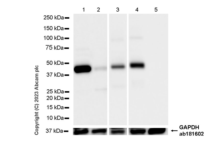 Western blot - Anti-Cytokeratin 18 antibody [RM1051] - BSA and Azide free (ab315097), expandable thumbnail