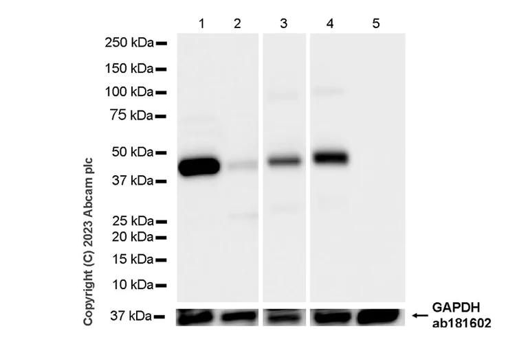 Western blot - Anti-Cytokeratin 18 antibody [RM1051] - BSA and Azide free (AB315097)